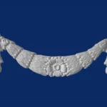 Gipsana aplikacija - Porta 4